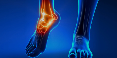 Запись вебинара «Хирургическое лечение патологии стопы» 5 октября