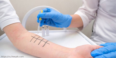 Вебинар «Аллергия сегодня», 14 октября 2021 года