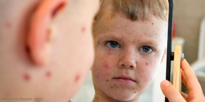 Конференция «Поражение кожи при инфекционных заболеваниях у детей: междисциплинарная проблема», 21 ноября 2023 года