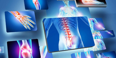 Утверждены временные рекомендации по работе отделений травматолого-ортопедического профиля