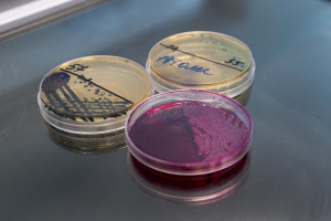 База данных онкологических пациентов с учетом региональных особенностей (Индия)