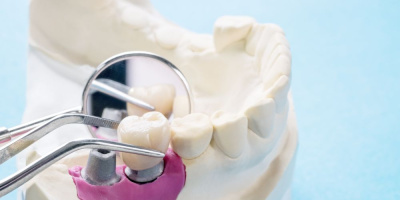 День зубного техника