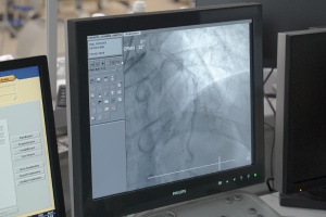 Лечение аневризмы с помощью нанороботов (Китай, Шотландия) 