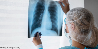 Конференция «Внебольничные пневмонии: этиология, особенности диагностики, осложнения», 13 декабря 2024 года