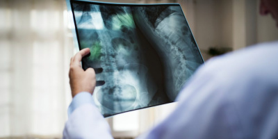 Научно-практическая конференция «Системная ревматология», 22–23 ноября 2021 года