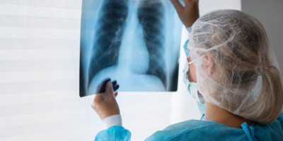 Семинар «Нормативно-правовое обеспечение мероприятий, направленных на профилактику и раннее выявление туберкулеза у взрослого населения», 20 марта 2024 года