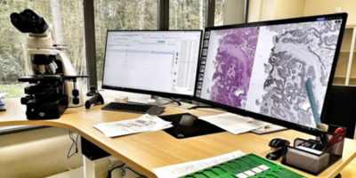 Цифровизация патологоанатомической службы в онкологии