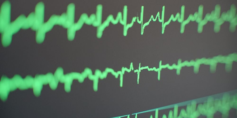 В Москве стартовал цикл школ сердечно-сосудистых хирургов