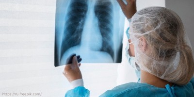 Семинар «Нормативно-правовое обеспечение мероприятий, направленных на профилактику и раннее выявление туберкулеза у взрослого населения», 20 марта 2024 года