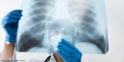 Семинар, посвященный вопросам организации выявления больных с заразными формами туберкулеза, 5 марта 2025 года