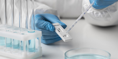 За последние пять лет среди горожан снизился уровень заболеваемости кишечными инфекциями 