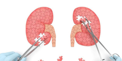 Как питаться пациентам с заболеваниями почек во время пандемии COVID-19: гид от трансплантологов