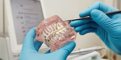 Всемирный день ортодонта