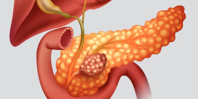 Состоялась конференция «Принципы дифференциальной диагностики и лечения заболеваний поджелудочной железы и желчных путей»