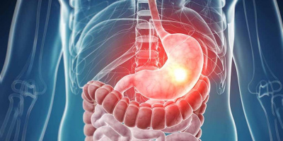 Запись вебинара по хирургической коррекции пациентов с гастроэзофагеальной рефлюксной болезнью и грыжей пищеводного отверстия диафрагмы 12 октября в 14:00