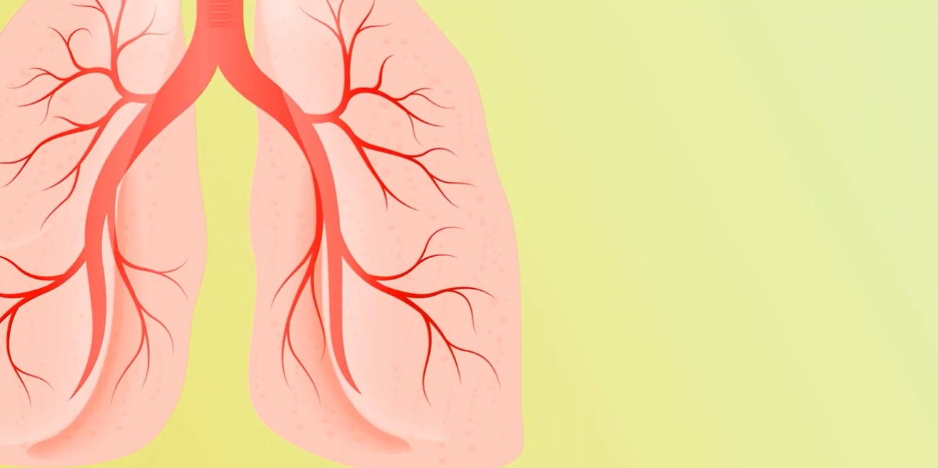 «Это должен знать каждый»: туберкулез