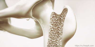Запись вебинара «Остеопороз – немая эпидемия 21 века. Мнение травматолога» 20 октября