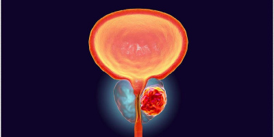 Клиника урологии под руководством главного уролога ДЗМ направила работу на Премию Москвы в области медицины