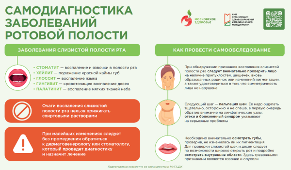 Самодиагностика заболеваний ротовой полости