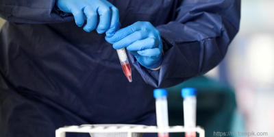 ОМО по урологии предлагает ознакомиться с обновленными рекомендациями по лечению COVID-19