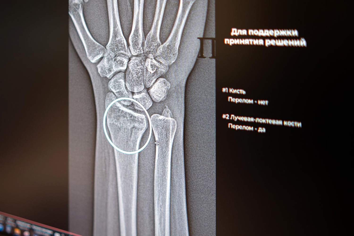 ИИ в помощь рентгенологам