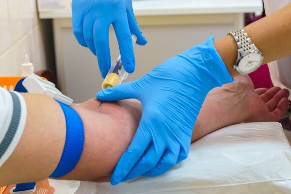 Анализ крови поможет выявить болезнь Паркинсона за годы до появления симптомов (Швеция, Норвегия)