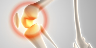 Онлайн-семинар «Медицинская реабилитация после эндопротезирования суставов нижних конечностей», 17 апреля 2024 года