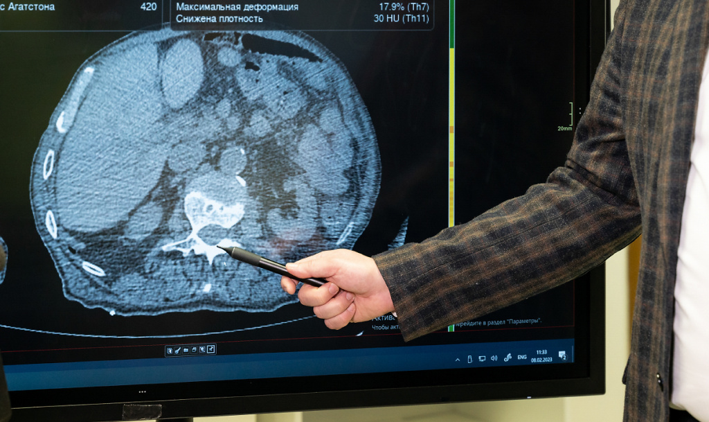 лучевая 1.jpg