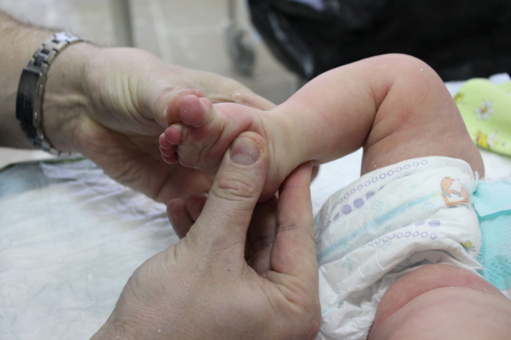 косолапость 4.jpg